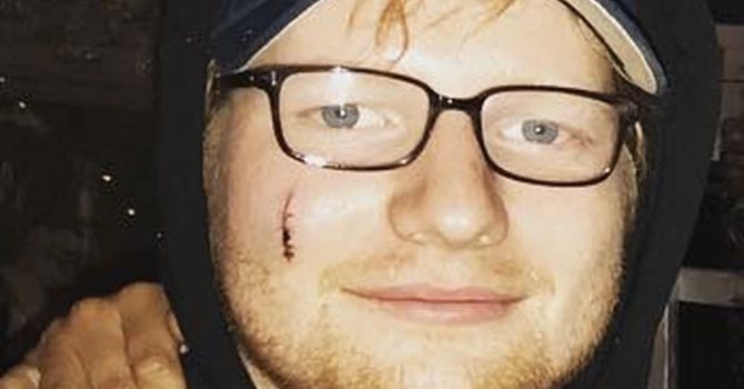 Ed Sheeran pociął się… mieczem